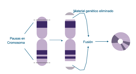 Sindrome Del Cromosoma 13 En Anillo www.biocaremedical.com.mx